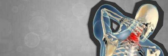 a nyaki régió osteochondrosisa az osteoarthritis kezelésének módszerei